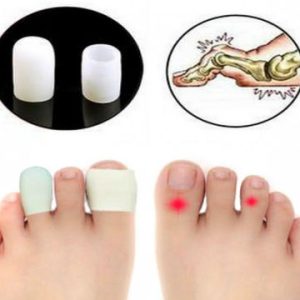 Ayak Parmağı Kemik Koruma Silikonu