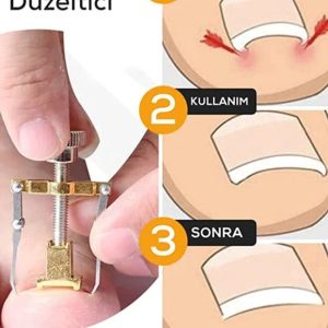 Batık Tırnak Çıkartıcı Orijinal Çelik Batan Tırnağı Düzeltme Aparatı Düzeltici Aleti Çıkarıcı Aparat